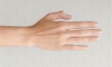 女子得荨麻疹能在皮肤划字 医生回应:无治愈手段