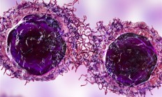 女子称1年半内家里4人确诊癌症：都有癌症病史